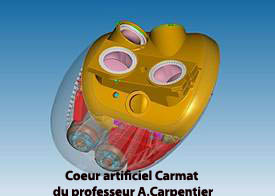 Coeur artificiel du professeur A. Carpentier
